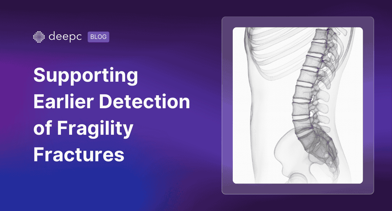 Making Opportunistic Vertebral Fracture Detection Work: What NICE EVA ...